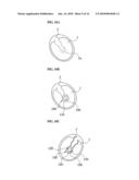 TRANSTYMPANIC VIBRATION DEVICE FOR IMPLANTABLE HEARING AID AND APPARATUS FOR INSTALLING THE SAME diagram and image