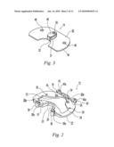 TIBIAL TRIALING ASSEMBLY AND METHOD OF TRIALING A TIBIAL IMPLANT diagram and image