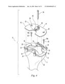 TIBIAL TRIALING ASSEMBLY AND METHOD OF TRIALING A TIBIAL IMPLANT diagram and image