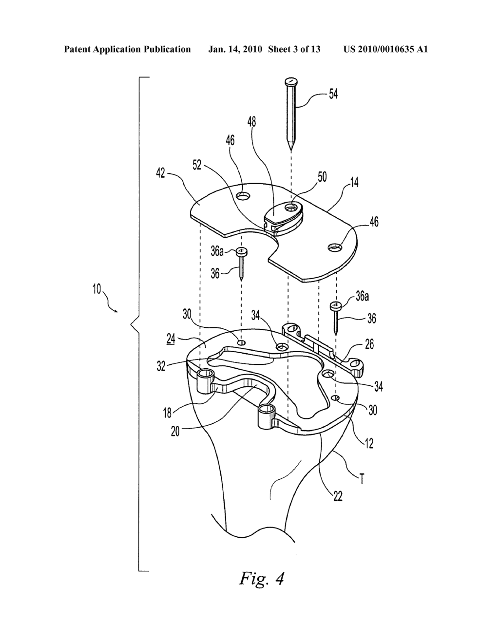 TIBIAL TRIALING ASSEMBLY AND METHOD OF TRIALING A TIBIAL IMPLANT - diagram, schematic, and image 04