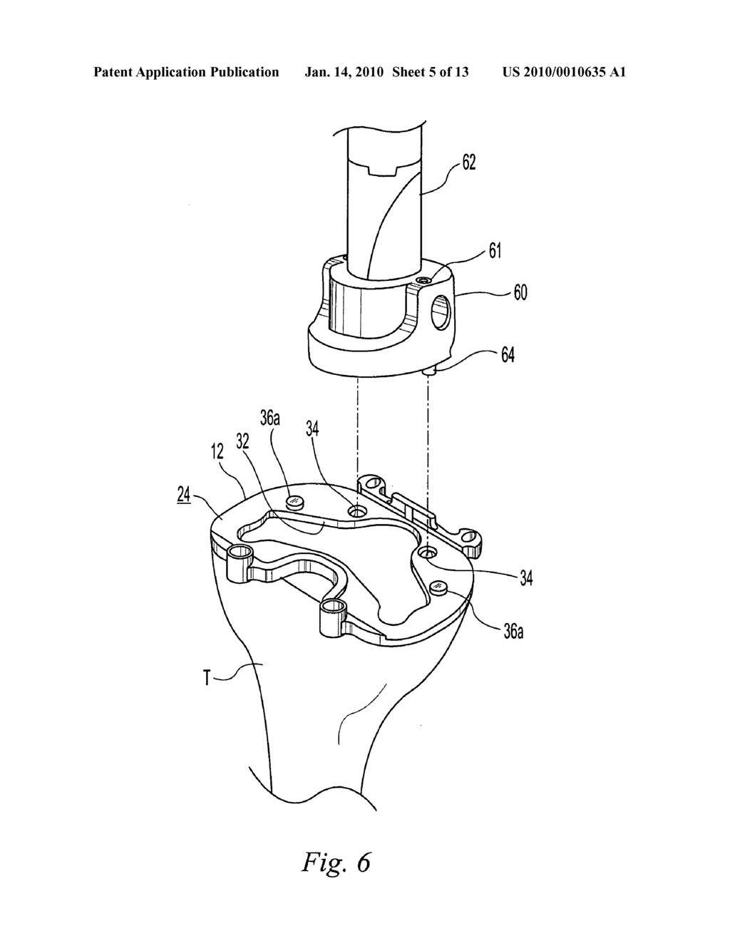 TIBIAL TRIALING ASSEMBLY AND METHOD OF TRIALING A TIBIAL IMPLANT - diagram, schematic, and image 06