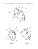 TIBIAL TRIALING ASSEMBLY AND METHOD OF TRIALING A TIBIAL IMPLANT diagram and image