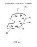 TIBIAL TRIALING ASSEMBLY AND METHOD OF TRIALING A TIBIAL IMPLANT diagram and image