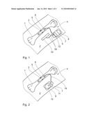 IMPLANT SYSTEM HAVING A FUNCTIONAL IMPLANT COMPOSED OF DEGRADABLE METAL MATERIAL diagram and image