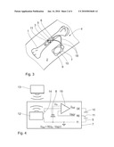 IMPLANT SYSTEM HAVING A FUNCTIONAL IMPLANT COMPOSED OF DEGRADABLE METAL MATERIAL diagram and image