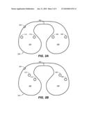 BIB diagram and image