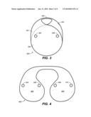 BIB diagram and image