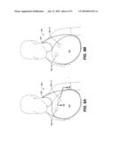 BIB diagram and image