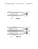 BIB diagram and image