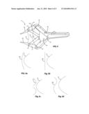 LEVER DIVICE diagram and image