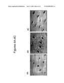 Tooth Whitening Compositions and Methods diagram and image