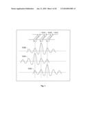 Semiconductor Device Portion Having Sub-193 Nanometers -Sized Gate Electrode Conductive Structures Formed from Linear Shaped Gate Electrode Layout Features Defined with Minimum End-to-End Spacing and Having At Least Eight Transistors diagram and image