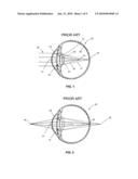 OPHTHALMIC LENS WITH MULTIPLE PHASE PLATES diagram and image