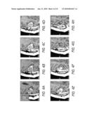 Leading-Edge Cancer Treatment diagram and image