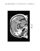 Leading-Edge Cancer Treatment diagram and image