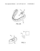 SYSTEMS AND METHODS FOR INTRA-ORAL BASED COMMUNICATIONS diagram and image