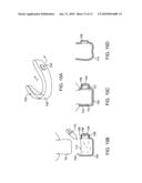 SYSTEMS AND METHODS FOR INTRA-ORAL BASED COMMUNICATIONS diagram and image