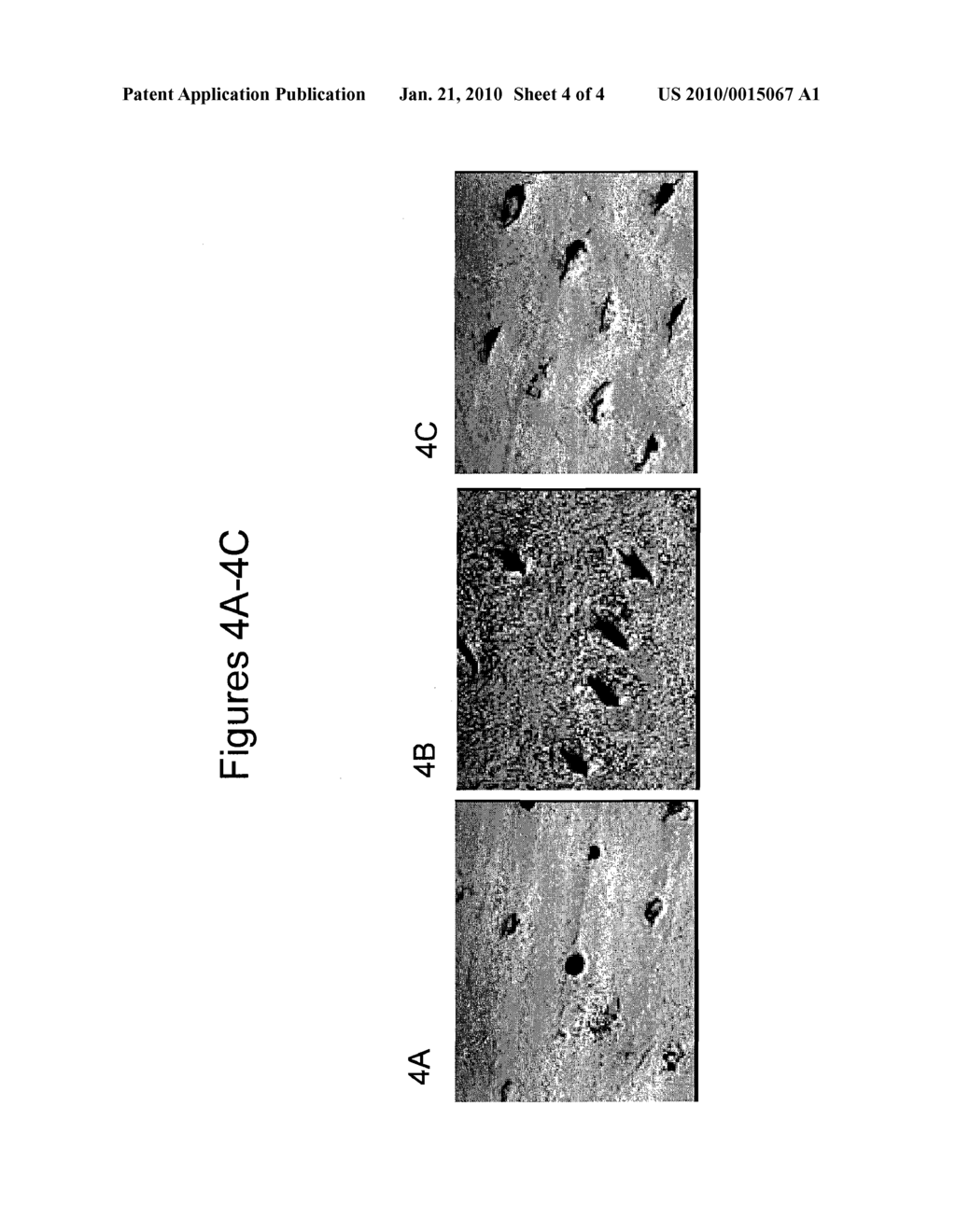 Tooth Whitening Compositions and Methods - diagram, schematic, and image 05