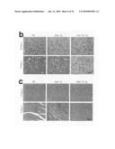 MODIFIED STAT1 TRANSGENE THAT CONFERS INTERFERON HYPERRESPONSIVENESS, METHODS AND USES THEREFOR diagram and image