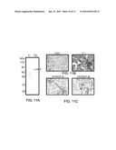 GRP78 as a Predictor of Responsiveness to Therapeutic Agents diagram and image