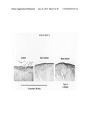 Methods of using F-spondin as a biomarker for cartilage degenerative conditions and bone diseases diagram and image