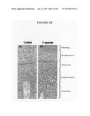 Methods of using F-spondin as a biomarker for cartilage degenerative conditions and bone diseases diagram and image