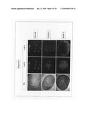 Methods of using F-spondin as a biomarker for cartilage degenerative conditions and bone diseases diagram and image