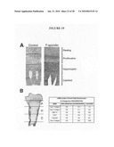 Methods of using F-spondin as a biomarker for cartilage degenerative conditions and bone diseases diagram and image