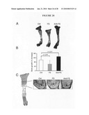 Methods of using F-spondin as a biomarker for cartilage degenerative conditions and bone diseases diagram and image