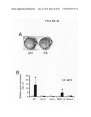 Methods of using F-spondin as a biomarker for cartilage degenerative conditions and bone diseases diagram and image