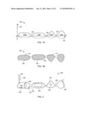 Orthodontic Devices diagram and image