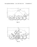 Orthodontic Devices diagram and image