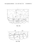 Orthodontic Devices diagram and image