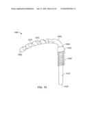 Orthodontic Devices diagram and image