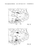 Orthodontic Devices diagram and image