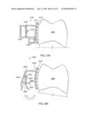 Orthodontic Devices diagram and image