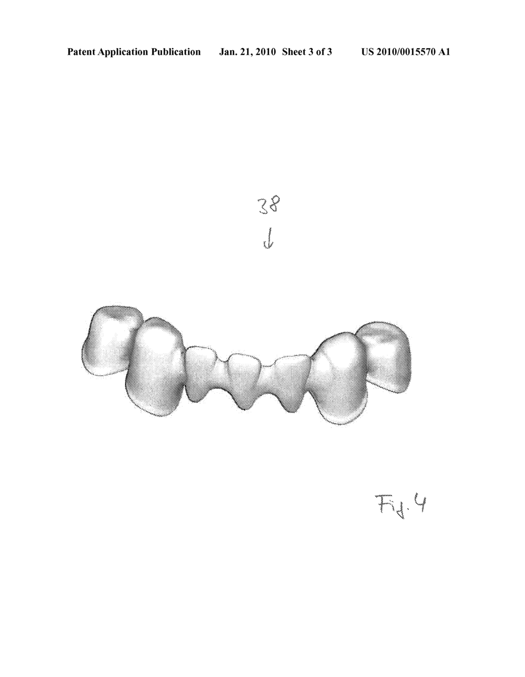 PROCEDURE FOR DIMENSIONALLY ACCURATE SINTERING OF A SHAPED PIECE - diagram, schematic, and image 04