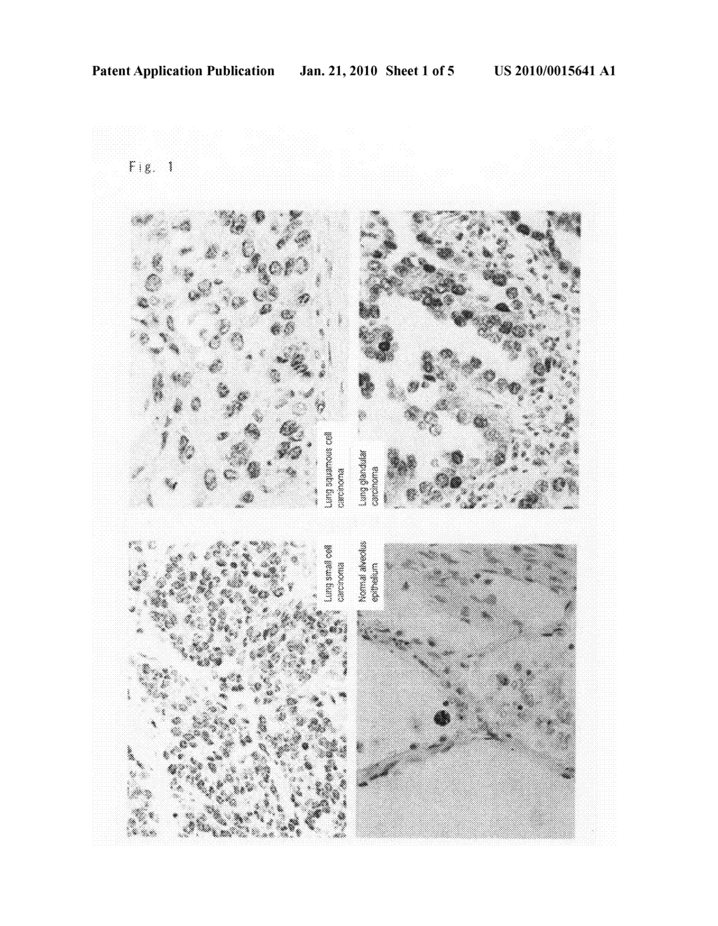 DIAGNOSTIC AGENT FOR TUMOR - diagram, schematic, and image 02