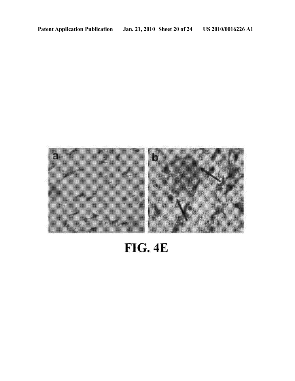 UNACYLATED GHRELIN AND ANALOGS AS THERAPEUTIC AGENTS FOR VASCULAR REMODELING IN DIABETIC PATIENTS AND TREATMENT OF CARDIOVASCULAR DISEASE - diagram, schematic, and image 21