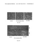 STRUCTURAL-BASED INHIBITORS OF THE GLUTATHIONE BINDING SITE IN ALDOSE REDUCTASE, METHODS OF SCREENING THEREFOR AND METHODS OF USE diagram and image