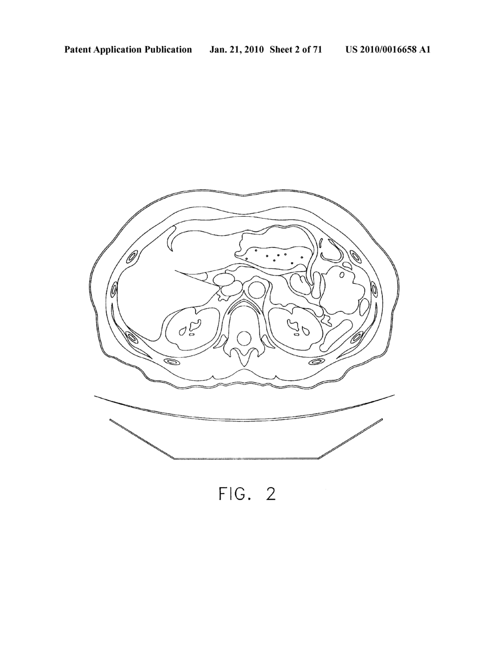 ANATOMICAL VISUALIZATION AND MEASUREMENT SYSTEM - diagram, schematic, and image 03