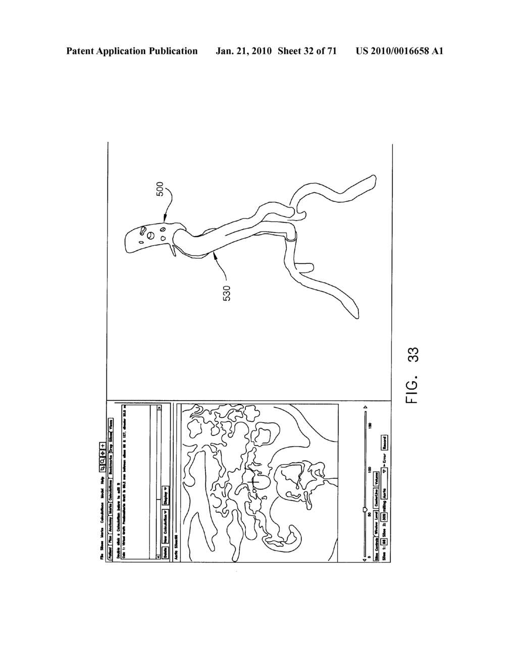 ANATOMICAL VISUALIZATION AND MEASUREMENT SYSTEM - diagram, schematic, and image 33