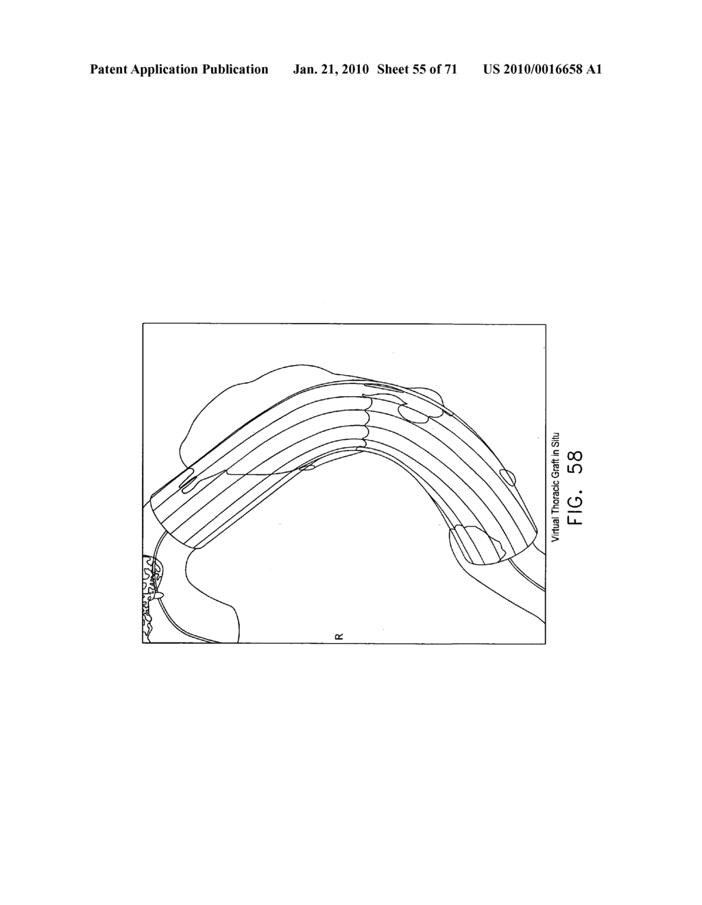 ANATOMICAL VISUALIZATION AND MEASUREMENT SYSTEM - diagram, schematic, and image 56