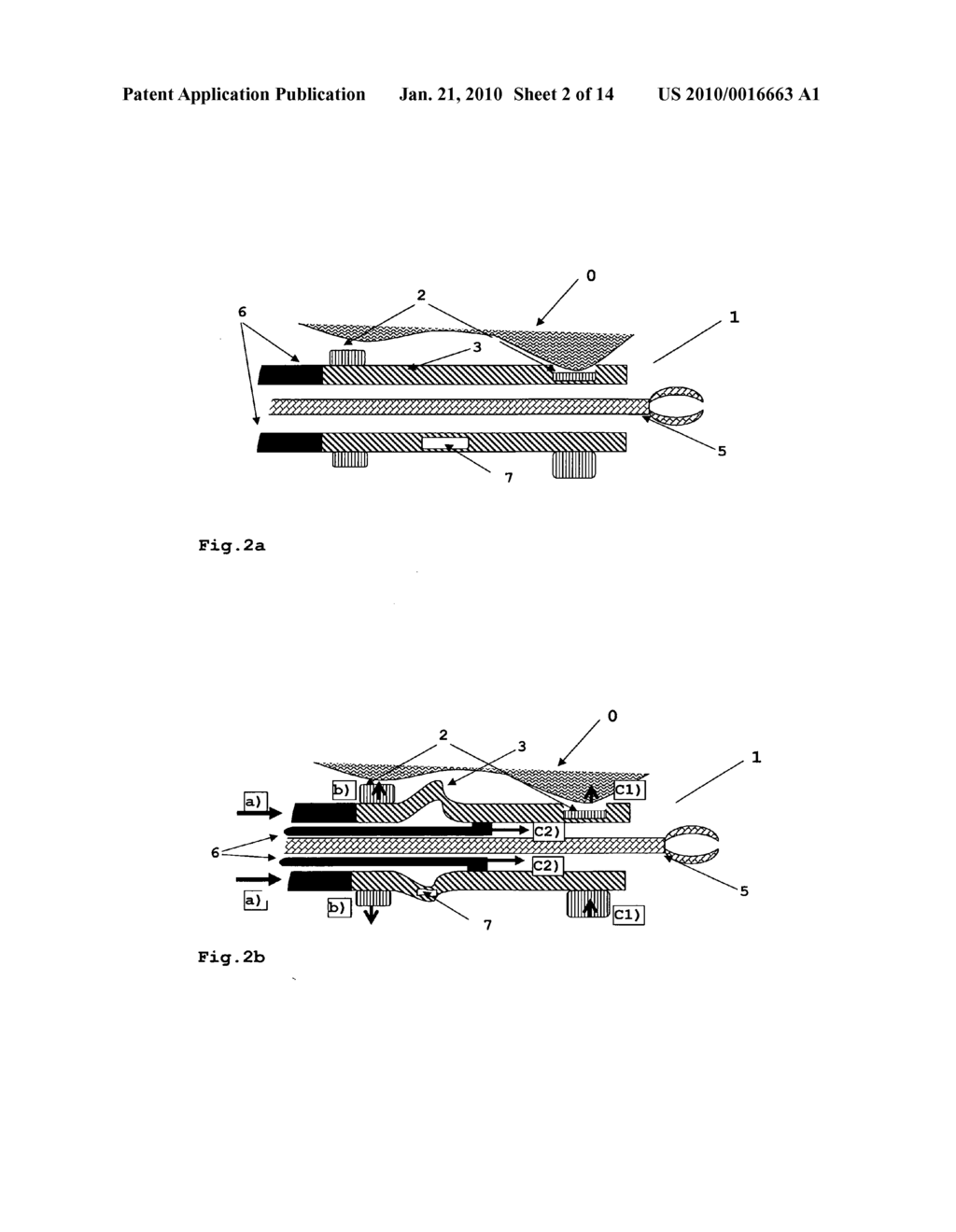 Device for the Guidance of Instruments in Cavities - diagram, schematic, and image 03