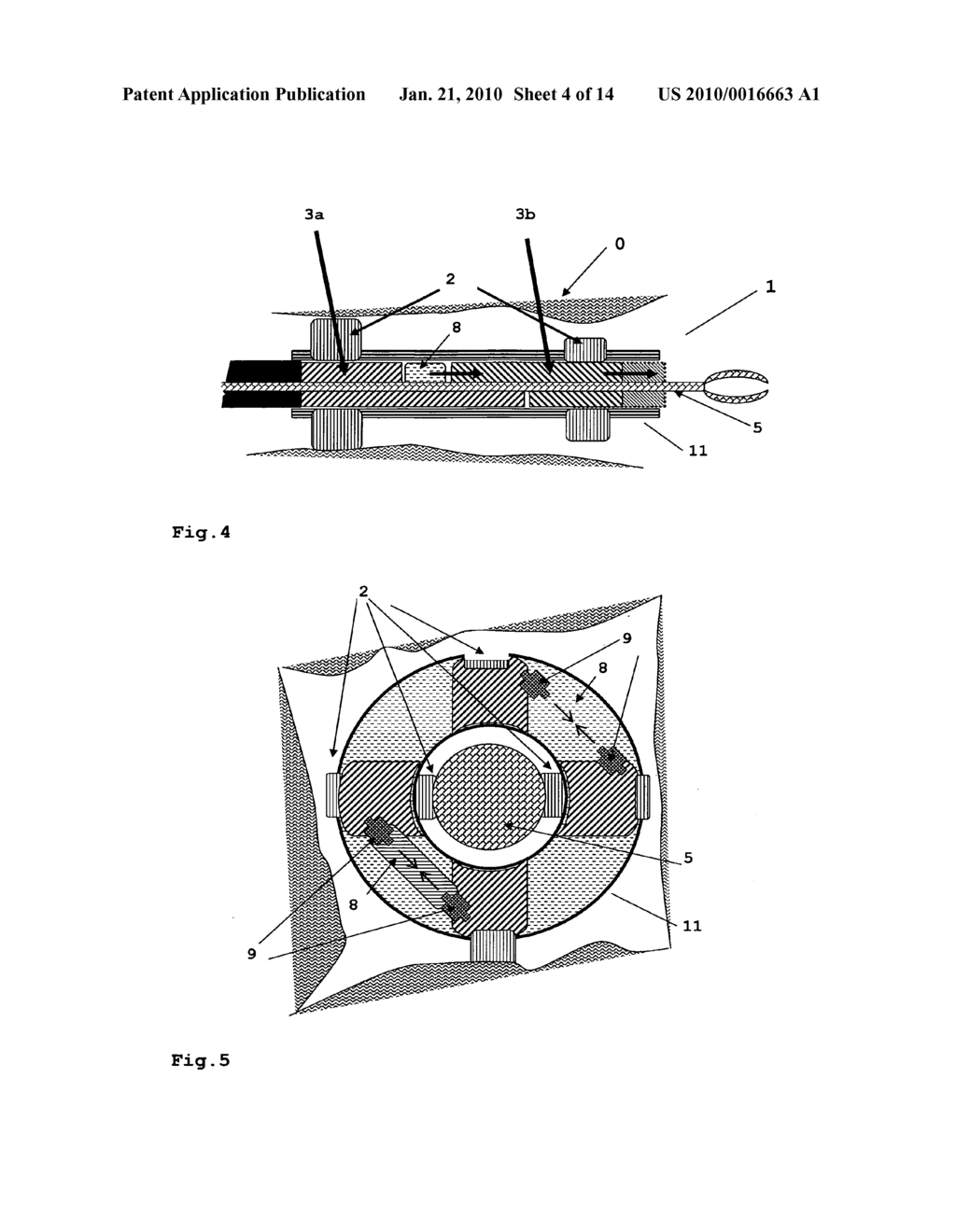 Device for the Guidance of Instruments in Cavities - diagram, schematic, and image 05