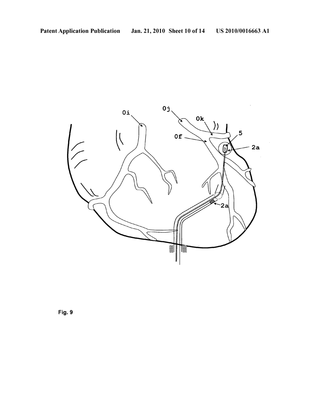 Device for the Guidance of Instruments in Cavities - diagram, schematic, and image 11