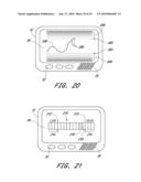 SIGNAL PROCESSING FOR CONTINUOUS ANALYTE SENSOR diagram and image