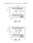 SIGNAL PROCESSING FOR CONTINUOUS ANALYTE SENSOR diagram and image