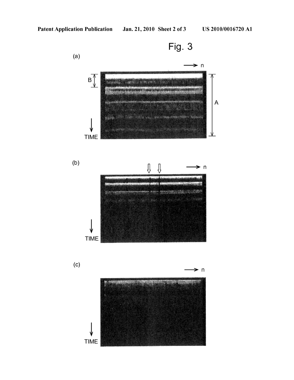 ULTRASONOGRAPH - diagram, schematic, and image 03