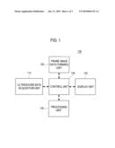 FORMATION OF AN ELASTIC IMAGE IN AN ULTRASOUND SYSTEM diagram and image